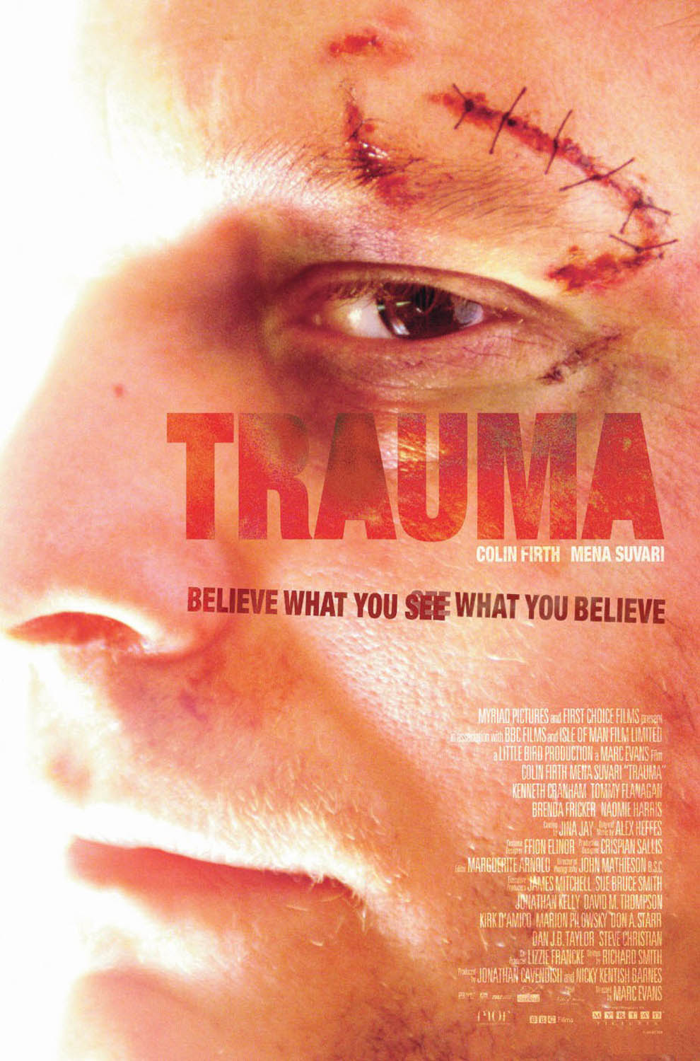 TRAUMA